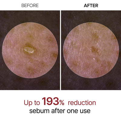 Supradil™ Glow Shot Rice Ampoule